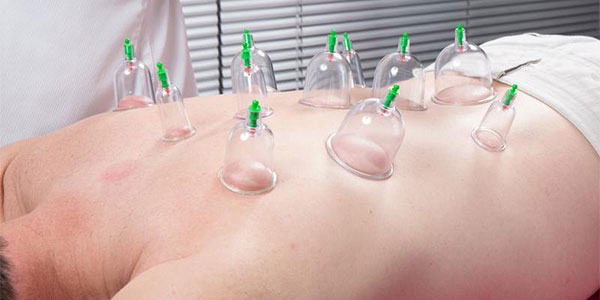 Air Cupping