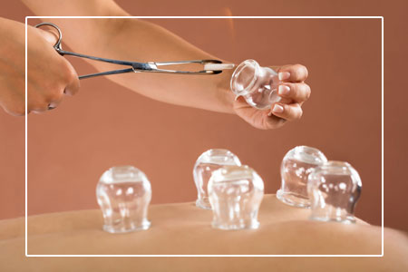 Cupping Therapy is a form of Alternative Medicine