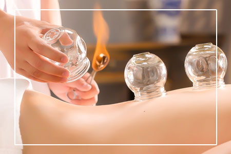 Cupping Therapy bodywork