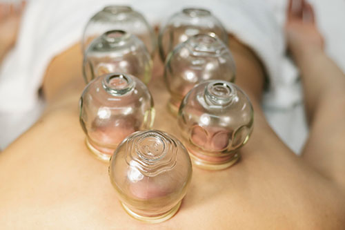 Wet Cupping Therapy